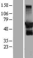 GPRIN2 / GRIN2 Protein - Western validation with an anti-DDK antibody * L: Control HEK293 lysate R: Over-expression lysate