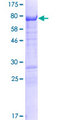 GPRIN2 / GRIN2 Protein - 12.5% SDS-PAGE of human GPRIN2 stained with Coomassie Blue