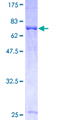 GPS1 / CSN1 Protein - 12.5% SDS-PAGE of human GPS1 stained with Coomassie Blue