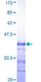 GPS2 Protein - 12.5% SDS-PAGE Stained with Coomassie Blue.
