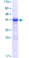 GPSM1 / AGS3 Protein - 12.5% SDS-PAGE of human GPSM1 stained with Coomassie Blue