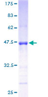 GPSM3 Protein - 12.5% SDS-PAGE of human GPSM3 stained with Coomassie Blue