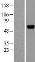 GPT / Alanine Transaminase Protein - Western validation with an anti-DDK antibody * L: Control HEK293 lysate R: Over-expression lysate