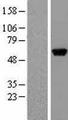 GPT / Alanine Transaminase Protein - Western validation with an anti-DDK antibody * L: Control HEK293 lysate R: Over-expression lysate