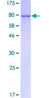 GPT / Alanine Transaminase Protein - 12.5% SDS-PAGE of human GPT stained with Coomassie Blue
