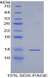 GPT / Alanine Transaminase Protein - Recombinant Alanine Aminotransferase By SDS-PAGE