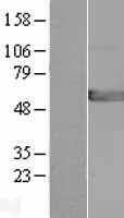 GPT2 / ALT2 Protein - Western validation with an anti-DDK antibody * L: Control HEK293 lysate R: Over-expression lysate