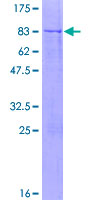 GPT2 / ALT2 Protein - 12.5% SDS-PAGE of human GPT2 stained with Coomassie Blue