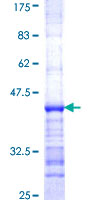 GPT2 / ALT2 Protein - 12.5% SDS-PAGE Stained with Coomassie Blue.
