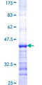 GPT2 / ALT2 Protein - 12.5% SDS-PAGE Stained with Coomassie Blue.