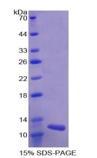 GPT2 / ALT2 Protein - Recombinant Alanine Aminotransferase 2 By SDS-PAGE