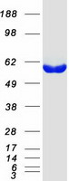 GPT2 / ALT2 Protein - Purified recombinant protein GPT2 was analyzed by SDS-PAGE gel and Coomassie Blue Staining