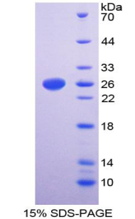 GPV / CD42d Protein - Recombinant  Glycoprotein V, Platelet By SDS-PAGE