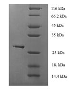 GPX1 / Glutathione Peroxidase Protein - (Tris-Glycine gel) Discontinuous SDS-PAGE (reduced) with 5% enrichment gel and 15% separation gel.