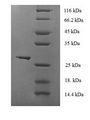 GPX1 / Glutathione Peroxidase Protein - (Tris-Glycine gel) Discontinuous SDS-PAGE (reduced) with 5% enrichment gel and 15% separation gel.