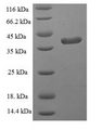GPX1 / Glutathione Peroxidase Protein - (Tris-Glycine gel) Discontinuous SDS-PAGE (reduced) with 5% enrichment gel and 15% separation gel.