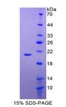 GPX1 / Glutathione Peroxidase Protein - Recombinant Glutathione Peroxidase 1 By SDS-PAGE