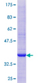 GPX5 Protein - 12.5% SDS-PAGE of human GPX5 stained with Coomassie Blue