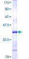 GPX5 Protein - 12.5% SDS-PAGE Stained with Coomassie Blue.