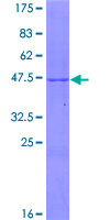 GPX7 Protein - 12.5% SDS-PAGE of human GPX7 stained with Coomassie Blue