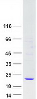 GPX7 Protein - Purified recombinant protein GPX7 was analyzed by SDS-PAGE gel and Coomassie Blue Staining