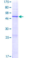 GPX8 Protein - 12.5% SDS-PAGE of human GPX8 stained with Coomassie Blue