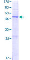 GPX8 Protein - 12.5% SDS-PAGE of human GPX8 stained with Coomassie Blue