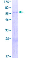 GRAB / RAB3IL1 Protein - 12.5% SDS-PAGE of human RAB3IL1 stained with Coomassie Blue