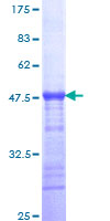 GRAMD1B Protein - 12.5% SDS-PAGE Stained with Coomassie Blue.