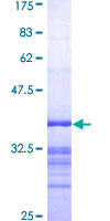 GRAP2 / GRID Protein - 12.5% SDS-PAGE Stained with Coomassie Blue.