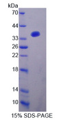 Gravin / AKAP12 Protein - Recombinant  A Kinase Anchor Protein 12 By SDS-PAGE