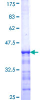 GRB14 Protein - 12.5% SDS-PAGE Stained with Coomassie Blue.