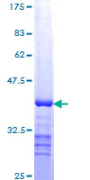 GRB2 Protein - 12.5% SDS-PAGE Stained with Coomassie Blue.