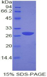 GRB2 Protein - Recombinant Growth Factor Receptor Bound Protein 2 By SDS-PAGE