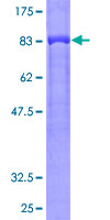 GRB7 Protein - 12.5% SDS-PAGE of human GRB7 stained with Coomassie Blue