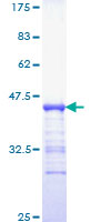 GRB7 Protein - 12.5% SDS-PAGE Stained with Coomassie Blue.