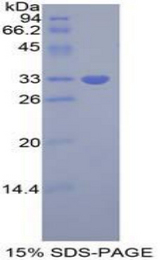 GRB7 Protein - Recombinant Growth Factor Receptor Bound Protein 7 By SDS-PAGE