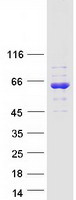 GRB7 Protein - Purified recombinant protein GRB7 was analyzed by SDS-PAGE gel and Coomassie Blue Staining