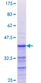 GREM1 / Gremlin-1 Protein - 12.5% SDS-PAGE Stained with Coomassie Blue.