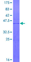 GREM1 / Gremlin-1 Protein - 12.5% SDS-PAGE Stained with Coomassie Blue.