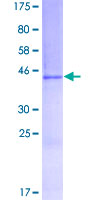 GREM2 / Gremlin 2 Protein - 12.5% SDS-PAGE of human GREM2 stained with Coomassie Blue