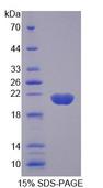 GREM2 / Gremlin 2 Protein - Recombinant  Gremlin 2 By SDS-PAGE