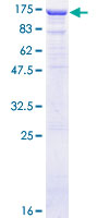 GRG4 / TLE4 Protein - 12.5% SDS-PAGE of human TLE4 stained with Coomassie Blue