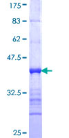 GRHL2 Protein - 12.5% SDS-PAGE Stained with Coomassie Blue.