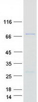 GRHL2 Protein - Purified recombinant protein GRHL2 was analyzed by SDS-PAGE gel and Coomassie Blue Staining