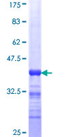 GRHL3 Protein - 12.5% SDS-PAGE Stained with Coomassie Blue.