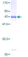 GRHPR / Glyoxylate Reductase Protein - 12.5% SDS-PAGE of human GRHPR stained with Coomassie Blue