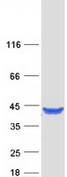 GRHPR / Glyoxylate Reductase Protein - Purified recombinant protein GRHPR was analyzed by SDS-PAGE gel and Coomassie Blue Staining
