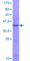 GRIA3 / GLUR3 Protein - 12.5% SDS-PAGE of human GRIA3 stained with Coomassie Blue