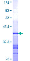 GRID2 Protein - 12.5% SDS-PAGE Stained with Coomassie Blue.